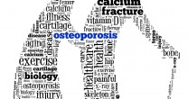 Alimente pentru tratamentul osteoporozei